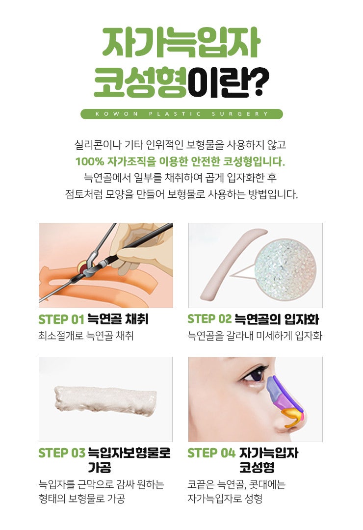 누구나 부러워하는 코 모양의 완성! 자가늑입자코성형! 사진 24