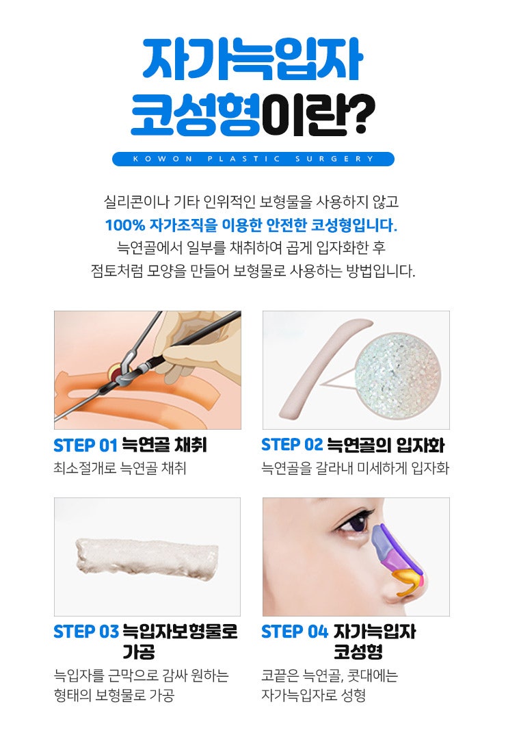 누구나 부러워하는 코 모양의 완성! 자가늑입자코성형! 사진 31