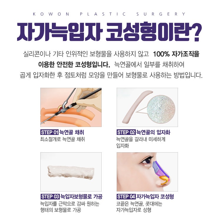 압구정코성형, 차세대 자가늑입자 코성형으로~