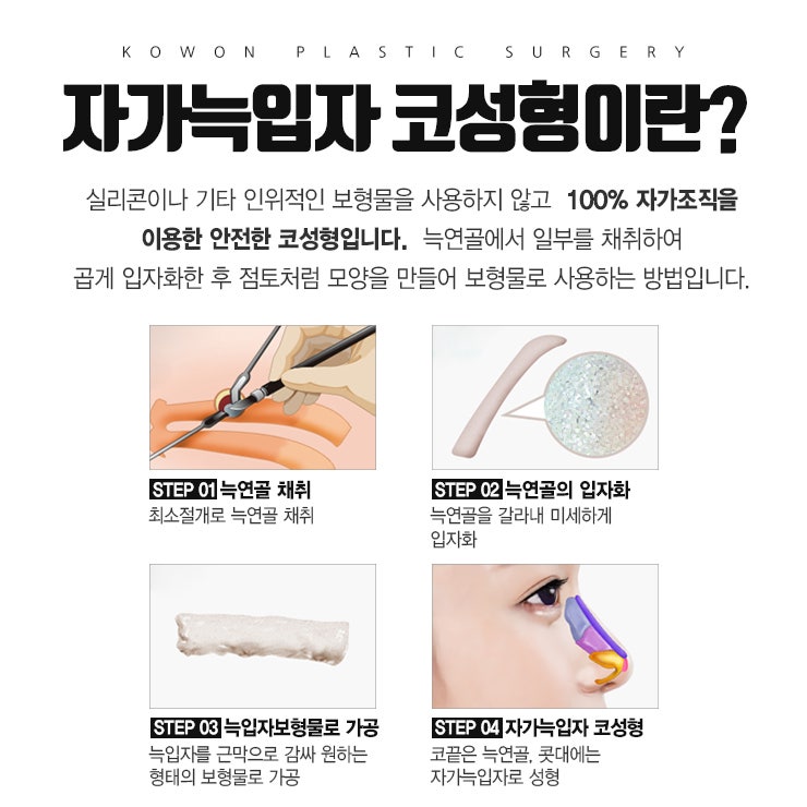 자가조직코성형의 안정성, 들어보셨나요?