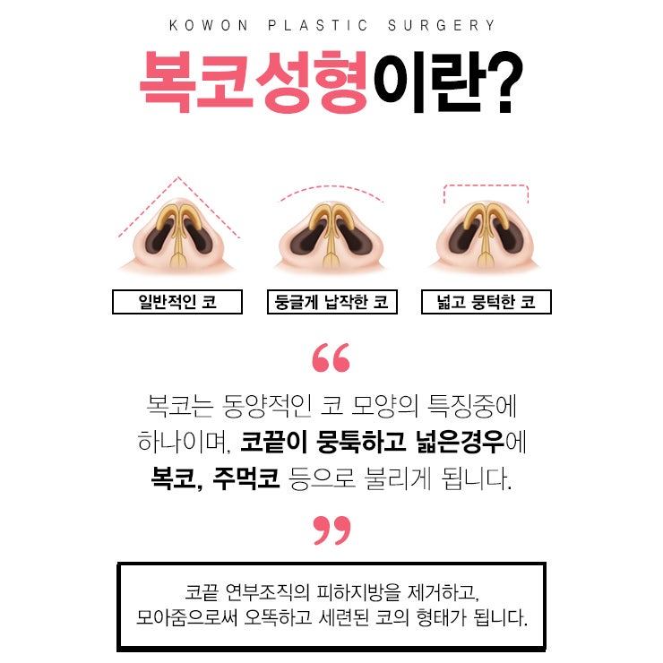 남자복코성형 두꺼운 복코는 끝, 멋진 콧대와 코끝 만들기!