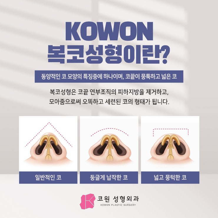 무보형물코성형, 여러분의 걱정과 불안을 알기에! 사진 10
