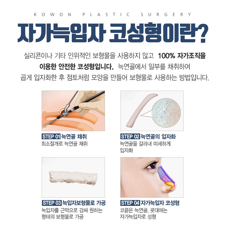 자가조직코성형, 자가늑입자로 자연스럽게 안전하게! 사진 2