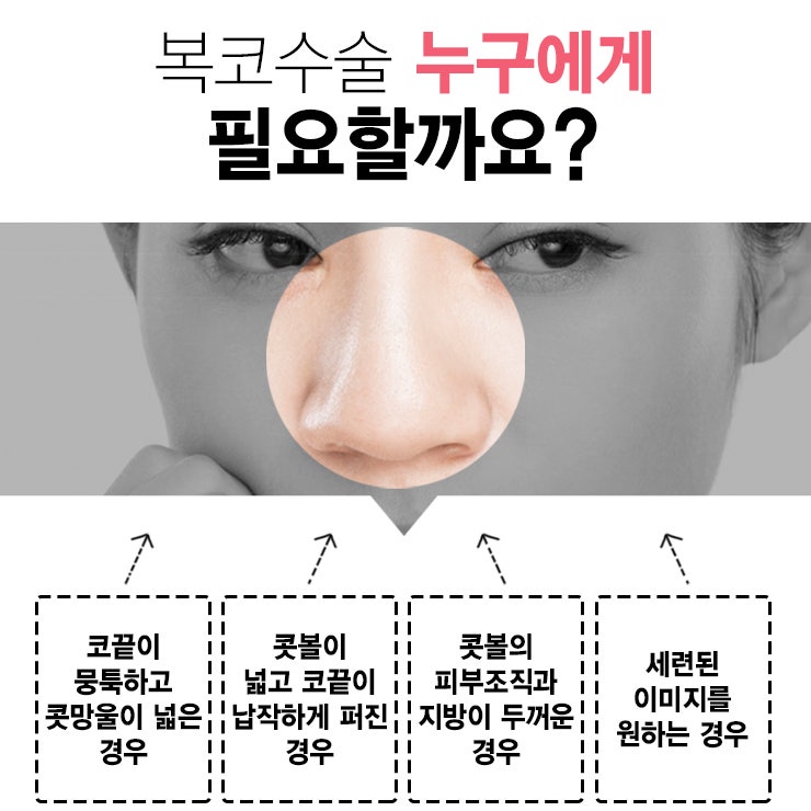복코수술전후 달라진 인상 확인해보고 싶다면 사진 6