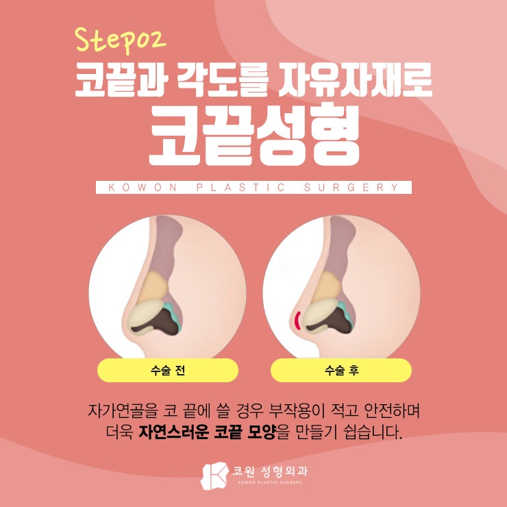 여자매부리코 자연스러운 개선을 원한다면 CLICK 사진 3