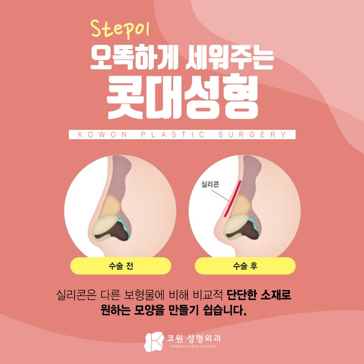 여자매부리코 자연스러운 개선을 원한다면 CLICK