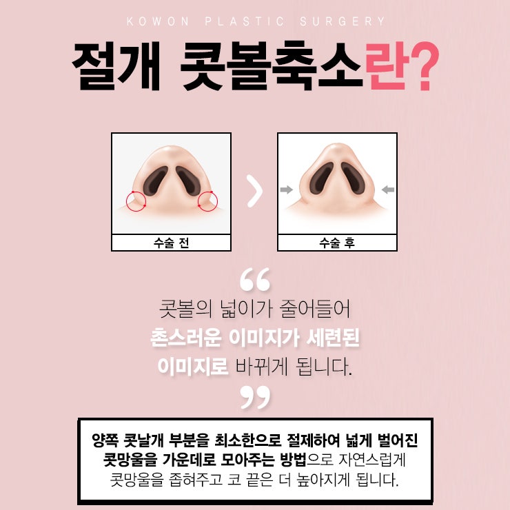 복코수술비용 코원과 함께 비교하는 방법 사진 4