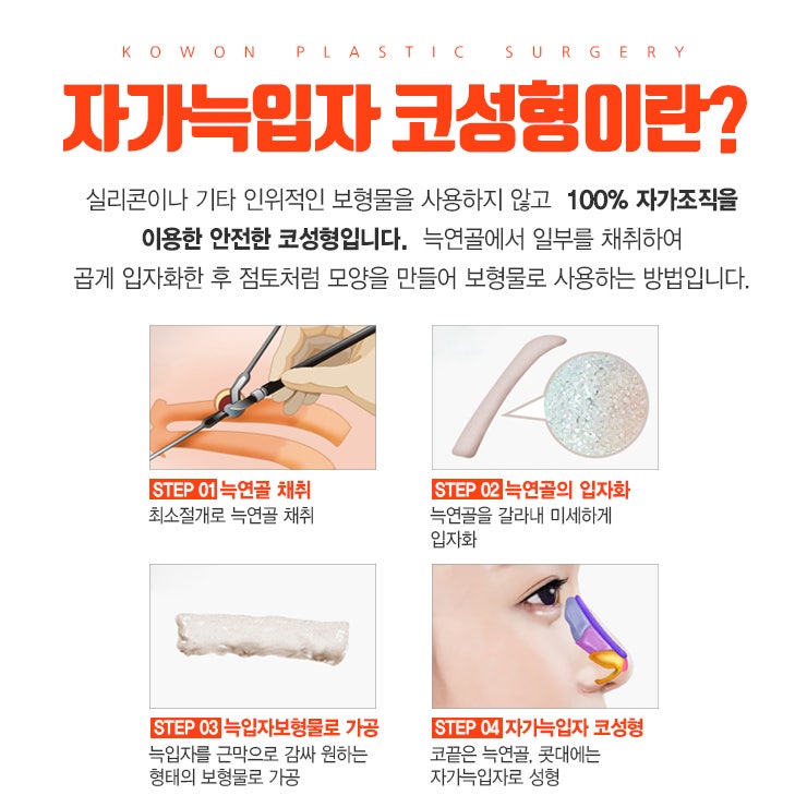 짧은코재수술 무보형물로 진행하고 싶다면