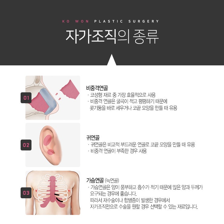 무보형물코성형 Q&A 살펴보기 사진 3