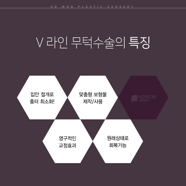 무턱보형물성형으로 부드러운 이미지 만들기 사진 3