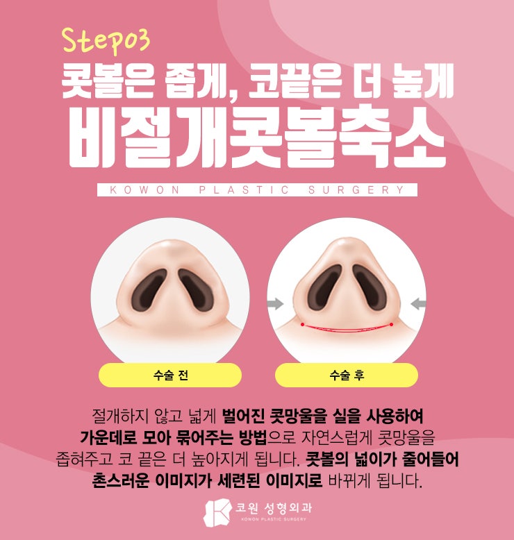 짧은코잘하는곳 만의 노하우 엿보기 사진 5