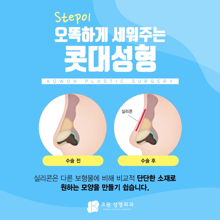압구정코재수술 필요한 분이라면