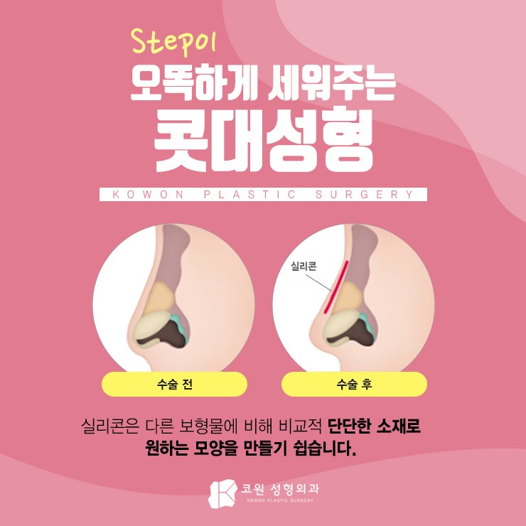 휜코수술잘하는곳 정답이 궁금하다면 CLCIK