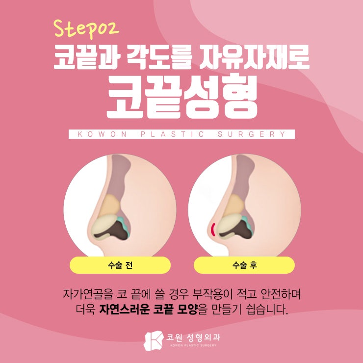 휜코수술잘하는곳 정답이 궁금하다면 CLCIK 사진 3