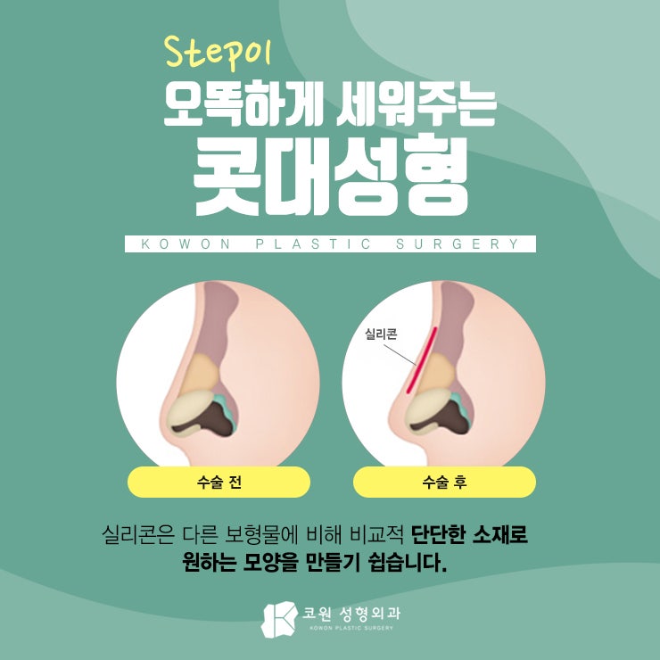 낮은코수술후기 꼼꼼히 확인하세요!