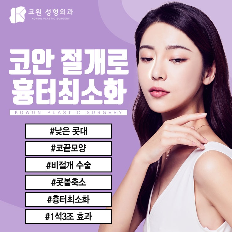매부리코수술 만족스러운 결과는 사진 5