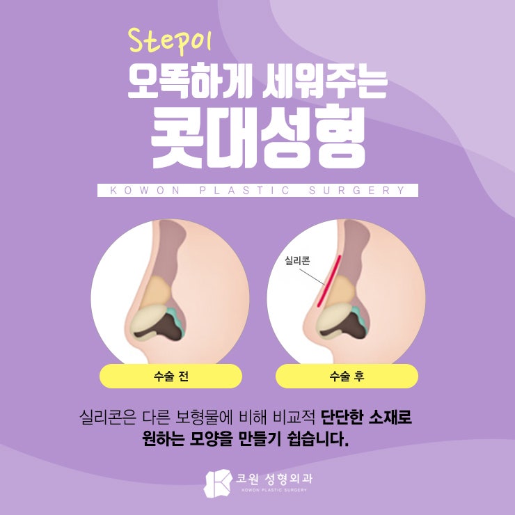 강남코재수술추천 3STEP코성형으로 끝내요