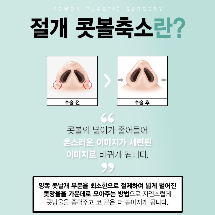 복코재수술 잘하는 압구정성형외과 방문하기 사진 4