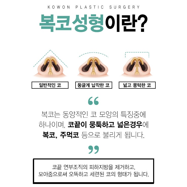 복코재수술 잘하는 압구정성형외과 방문하기