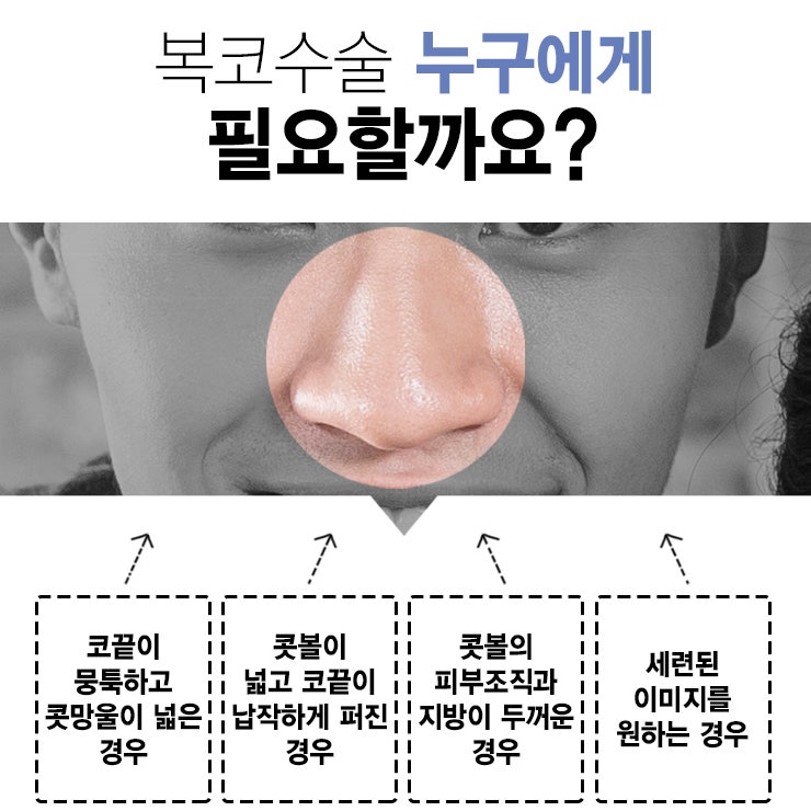 남자복코수술잘하는곳 코원성형외과가 정답 사진 6