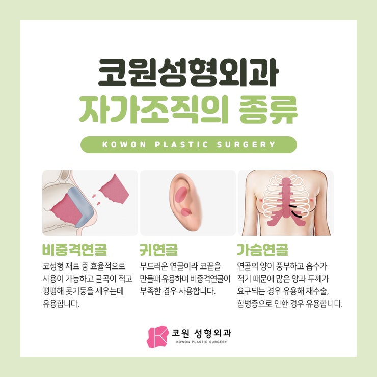 매부리코교정 '무보형물'로 가능해 사진 3