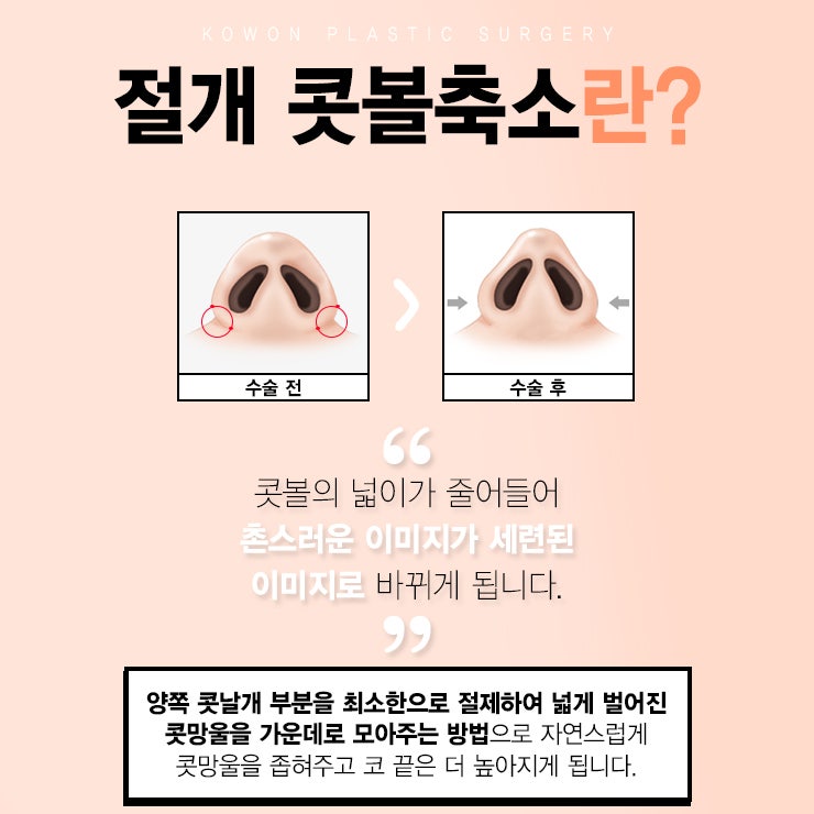 여자복코수술비용 만족스러운 선택 사진 3