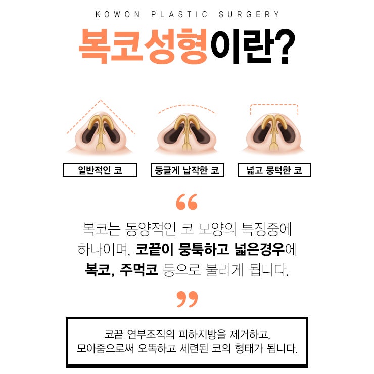 여자복코수술비용 만족스러운 선택