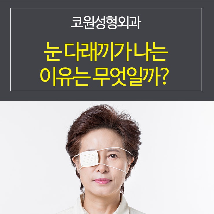 눈 다래끼가 나는 이유, 코원성형외과와 알아보기