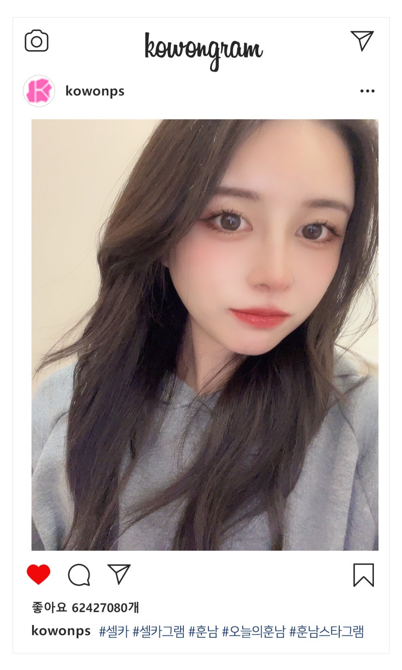들창코재수술 '자가늑'의 다른 점