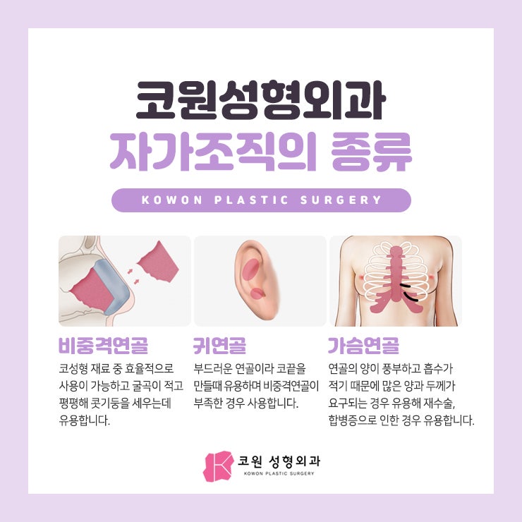 매부리코수술후기 '부작용' 낮추고 자연스럽게 사진 3