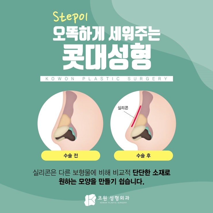 압구정코성형추천 올바르게 선택해보세요!