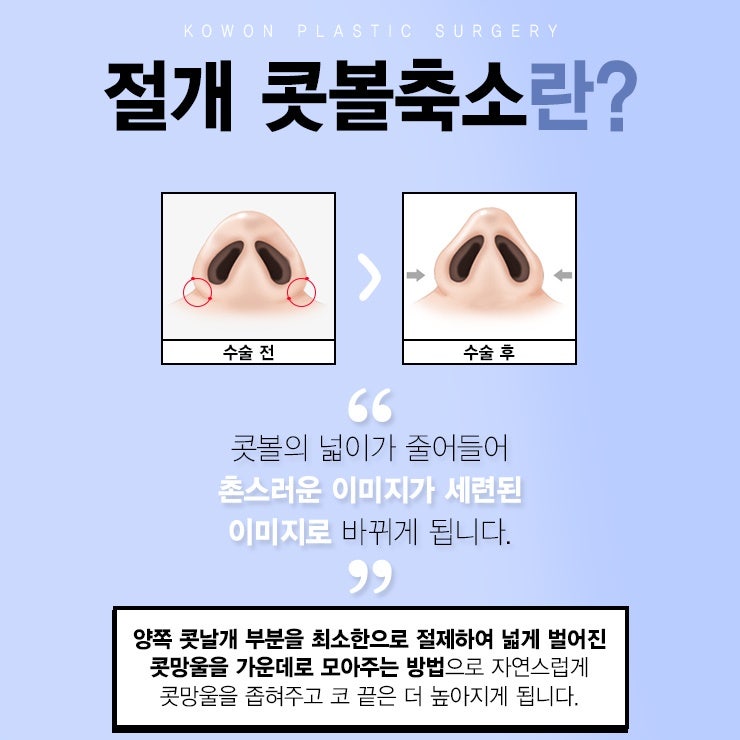 남자복코성형 뭉툭하지 않도록 사진 3