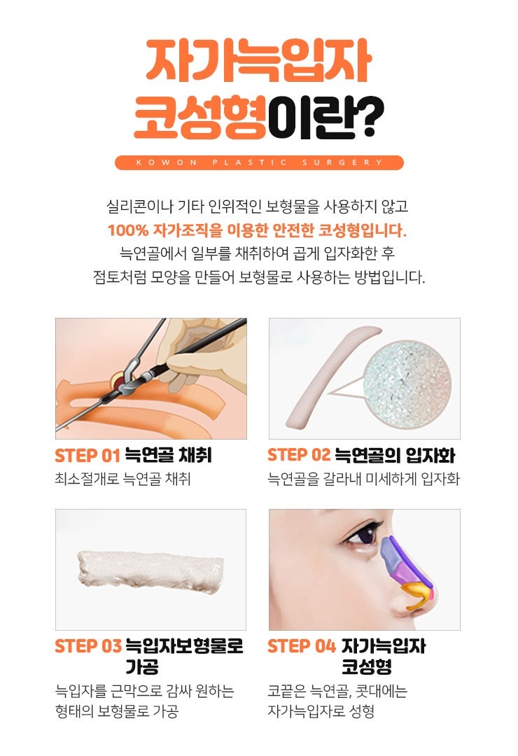 압구정코재수술 자가늑을 이용한 솔루션