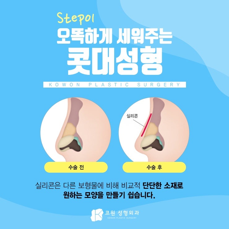 휜코성형가격 부담 덜고 만족스럽게!