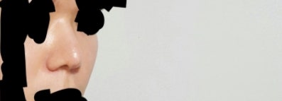 Q. 코성형코끝처짐 의심되는데