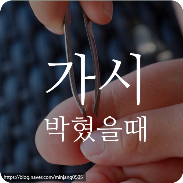 가시박혔을때 빼는법 올바른 대처