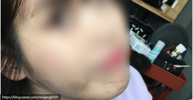 얼굴점위치 복점 흉점 관상 사진 11