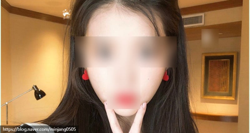 얼굴점위치 복점 흉점 관상 사진 10