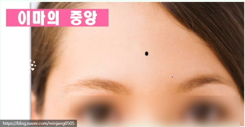 얼굴점위치 복점 흉점 관상 사진 5
