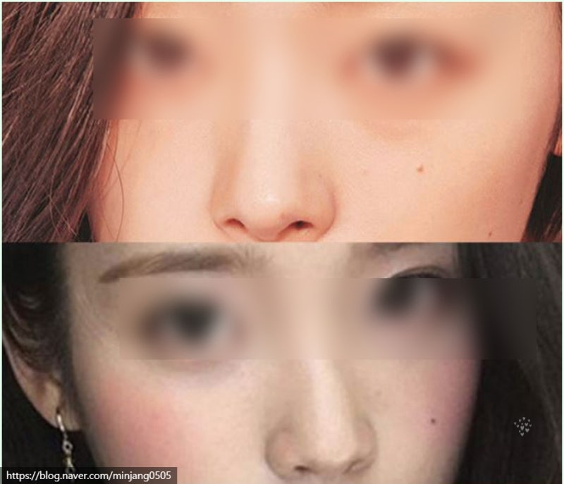 얼굴점위치 복점 흉점 관상 사진 9