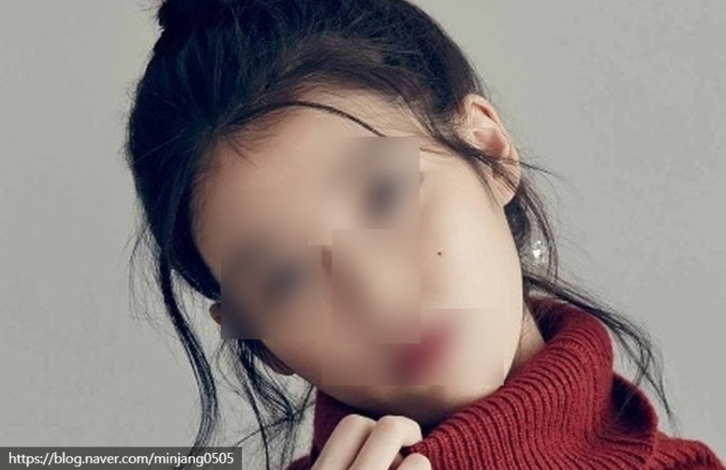 얼굴점위치 복점 흉점 관상 사진 8