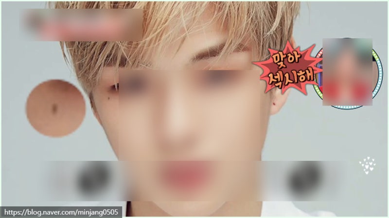 얼굴점위치 복점 흉점 관상 사진 7