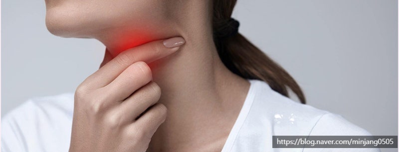 코로나목부음 증상 환절기 정보 사진 10