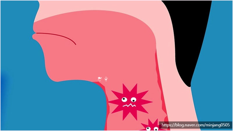 코로나목부음 증상 환절기 정보 사진 5