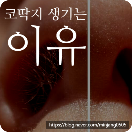 코딱지 생기는 이유 파내도 괜찮을까