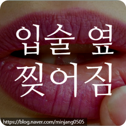 입술 옆 찢어짐 단순 건조함 원인일까