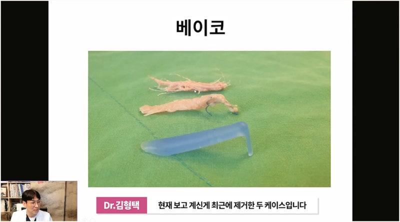 코수술 실밥 염증 증상 치료 예방방법 사진 10