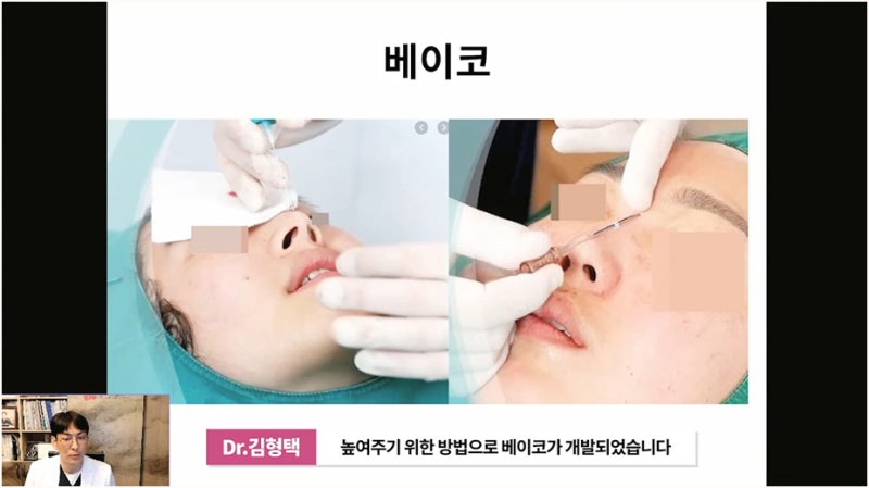 코수술 실밥 염증 증상 치료 예방방법