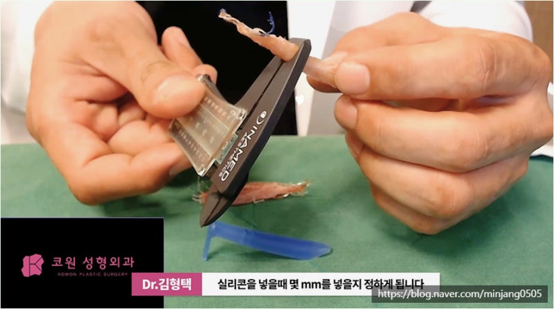 하이코 베이코 시술 실제거하는 방법 사진 13