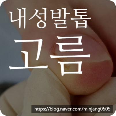 내성발톱고름 염증 없애는 법
